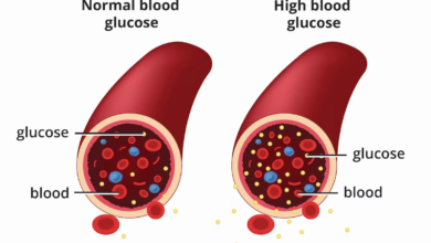 Diabetes Medication Comparison: Which One Is Right for You?