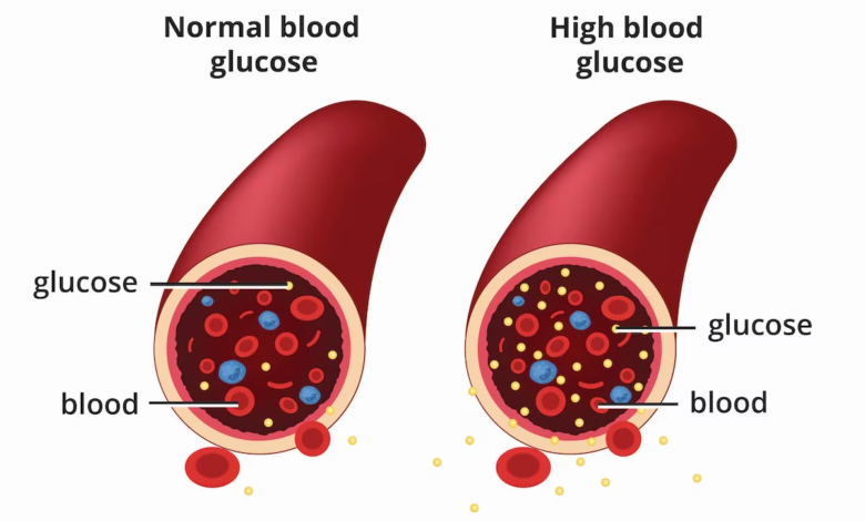 Diabetes Medication Comparison: Which One Is Right for You?